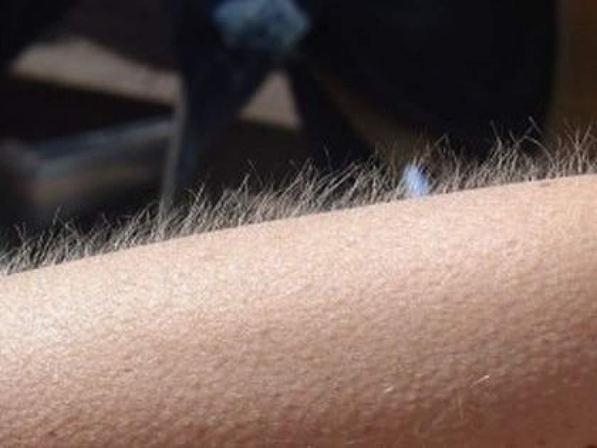 De ce ni se face pielea de gaină?